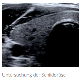 Das Bild zeigt ein Ultraschallbild der Schilddrüse