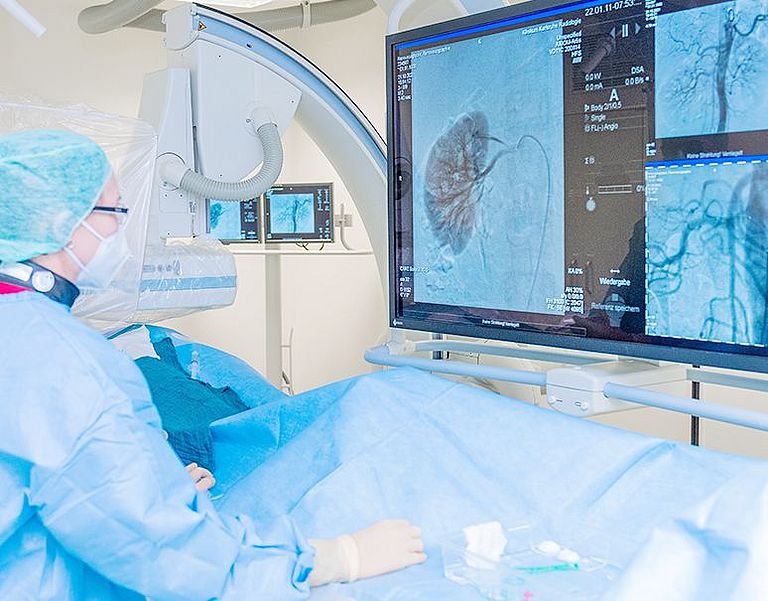 Das Bild zeigt die Behandlung einer Nierenarterienstenose in der Angiographie