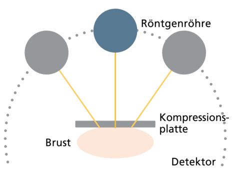 Das Bild zeigt das Schema der Funktionsweise der Tomosynthese